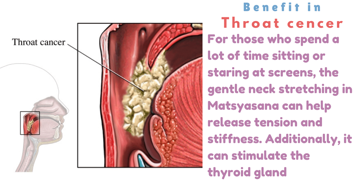 Matsyasana Benefits : 1 amazing boon for Thyroid Gland isue 11 Matsyasana Benefits_As throat cencer